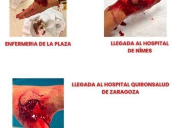 Castella denuncia la atención sanitaria recibida en Francia tras la grave herida en la mano sufrida en Vauvert